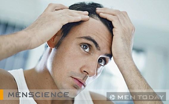 Cách chăm sóc tóc mỏng cho nam giới